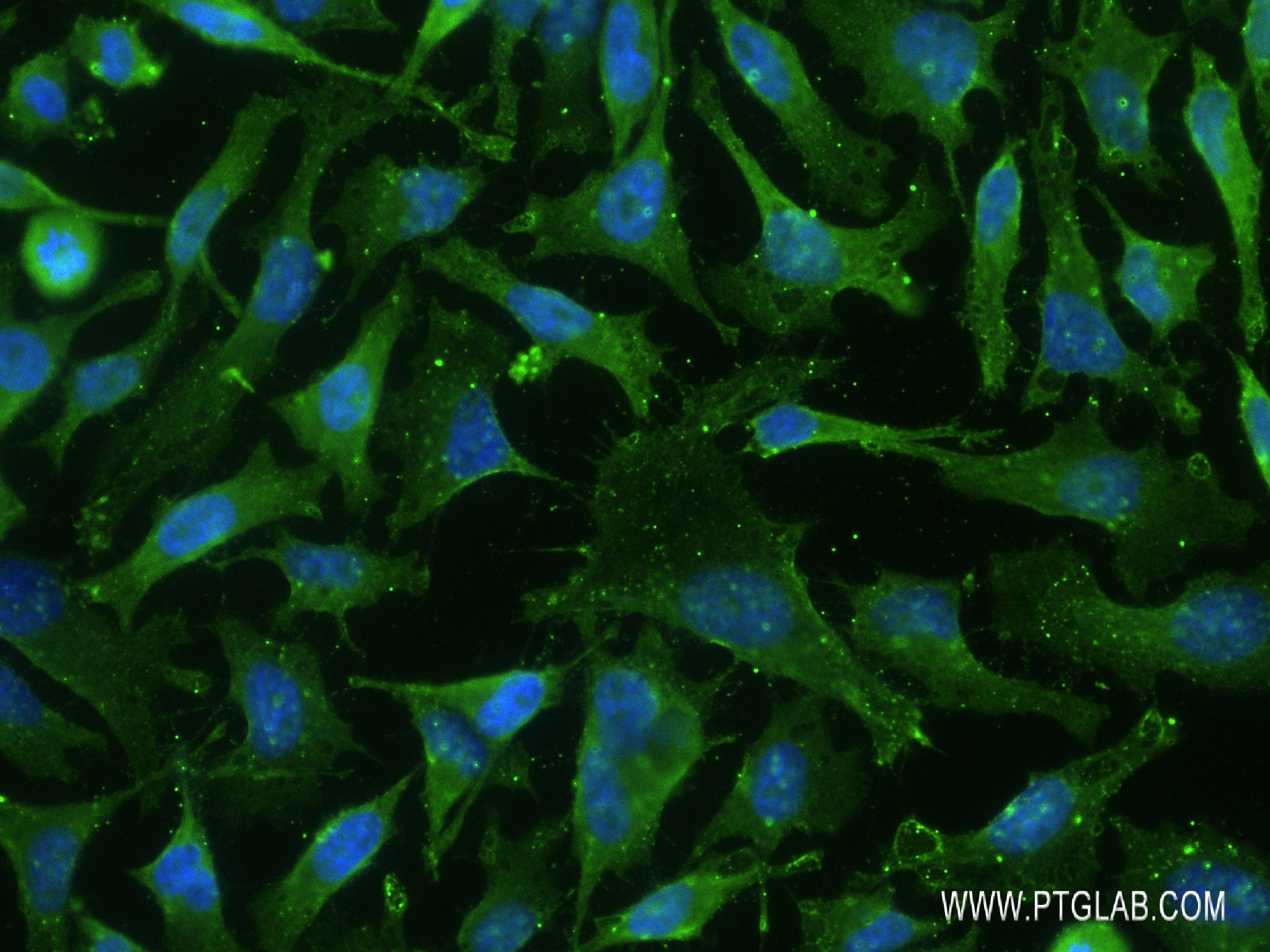 IF Staining of HeLa using 83174-5-RR (same clone as 83174-5-PBS)
