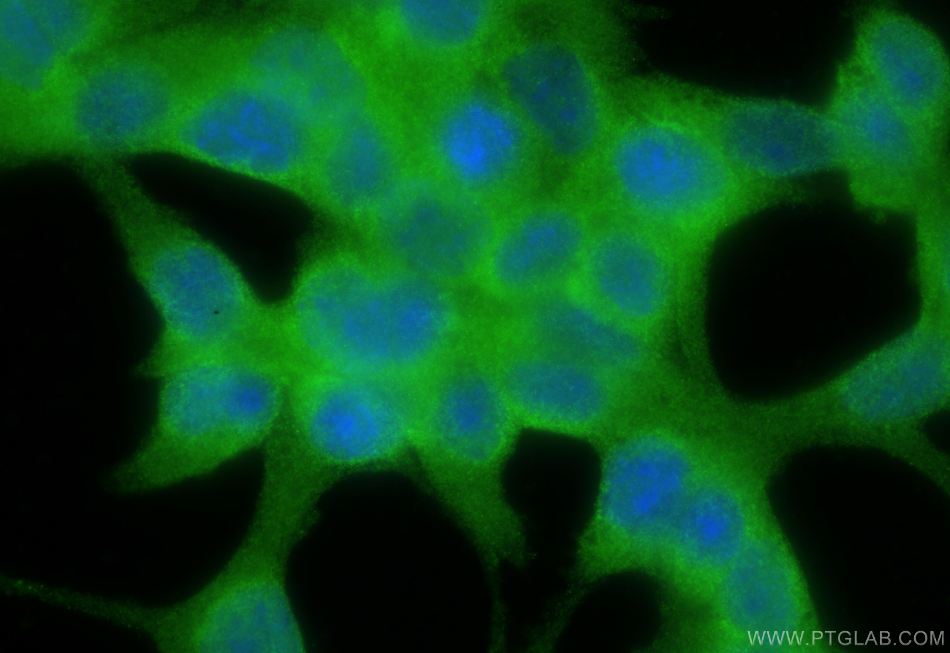 IF Staining of LNCaP using 83174-5-RR (same clone as 83174-5-PBS)