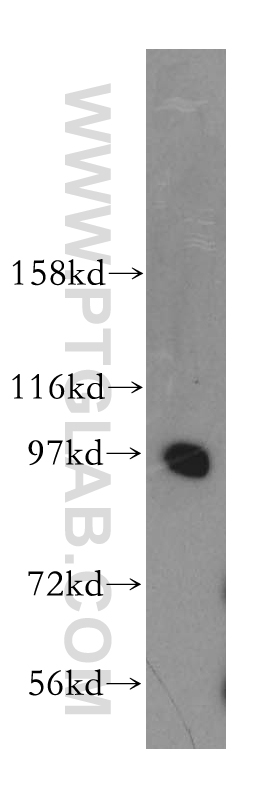 PRKD2 Polyclonal antibody