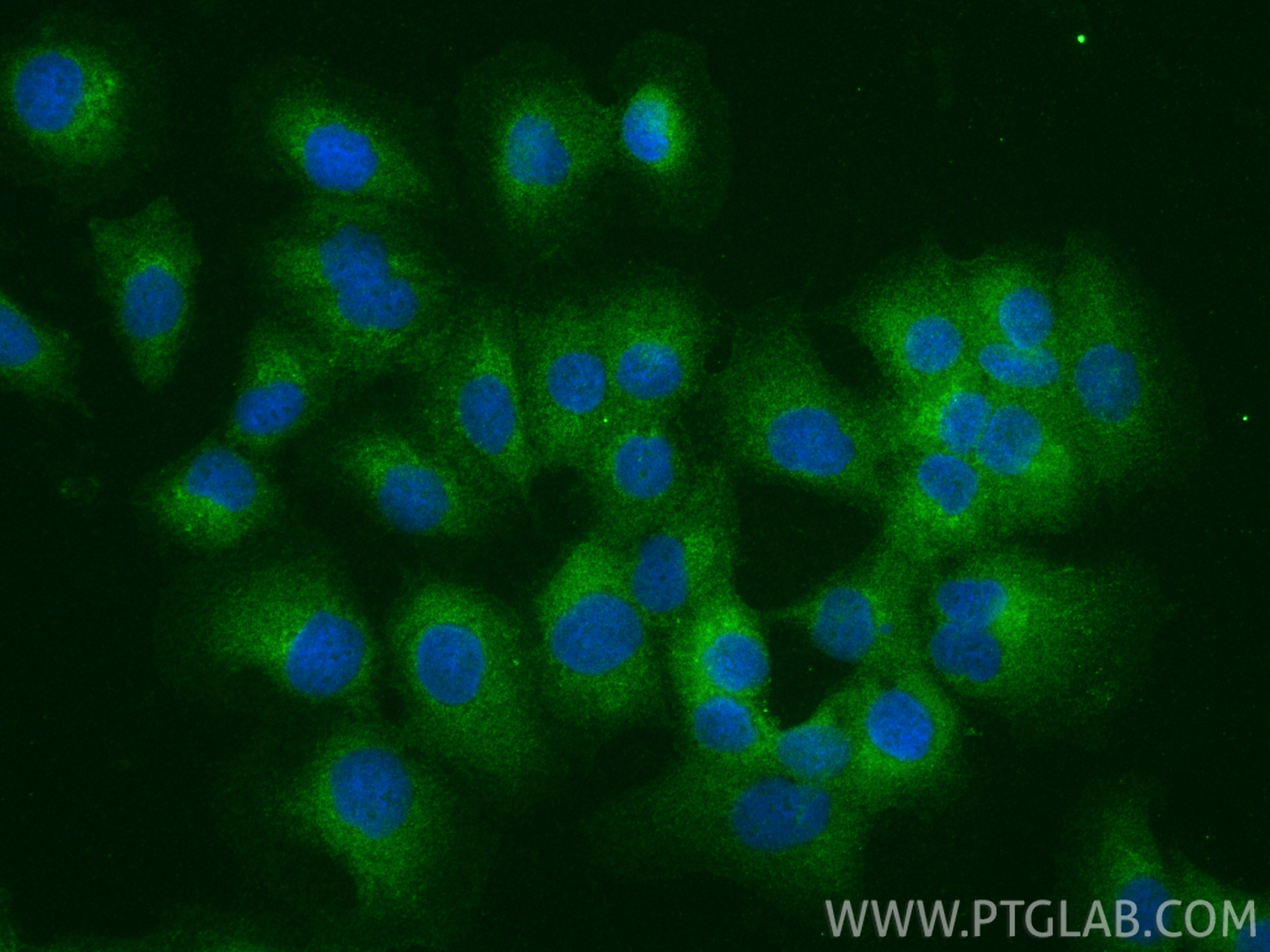 IF Staining of DU 145 using 12785-1-AP IF Staining of DU 145 using 12785-1-AP