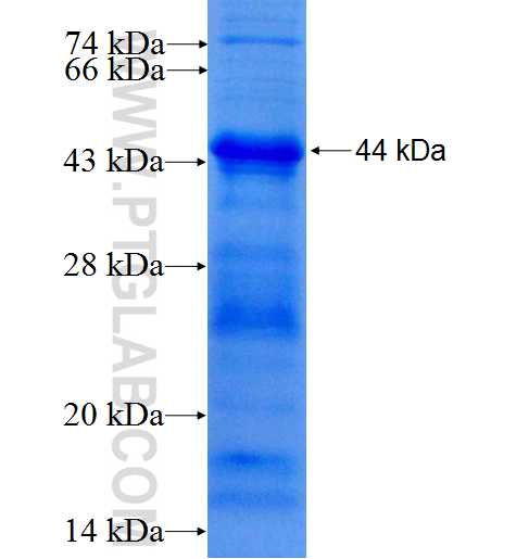 PRKD3 fusion protein Ag26164 SDS-PAGE PRKD3 fusion protein Ag26164 SDS-PAGE