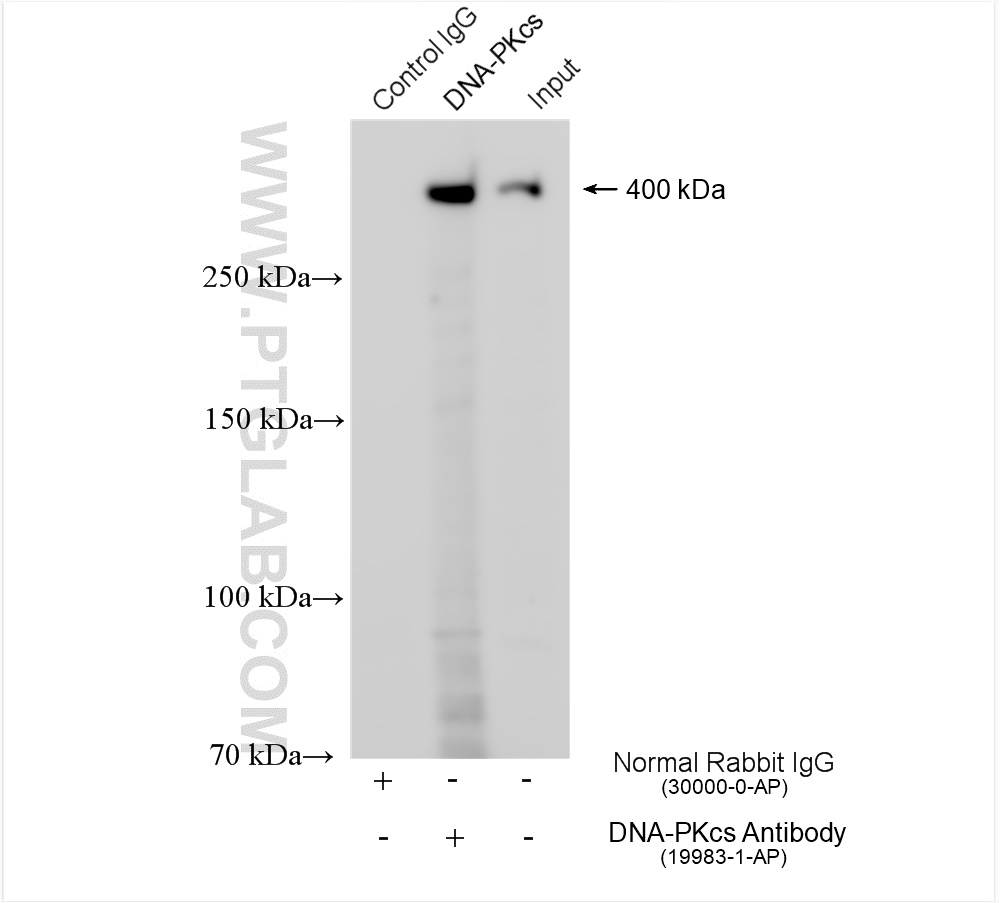 IP experiment of HeLa using 19983-1-AP