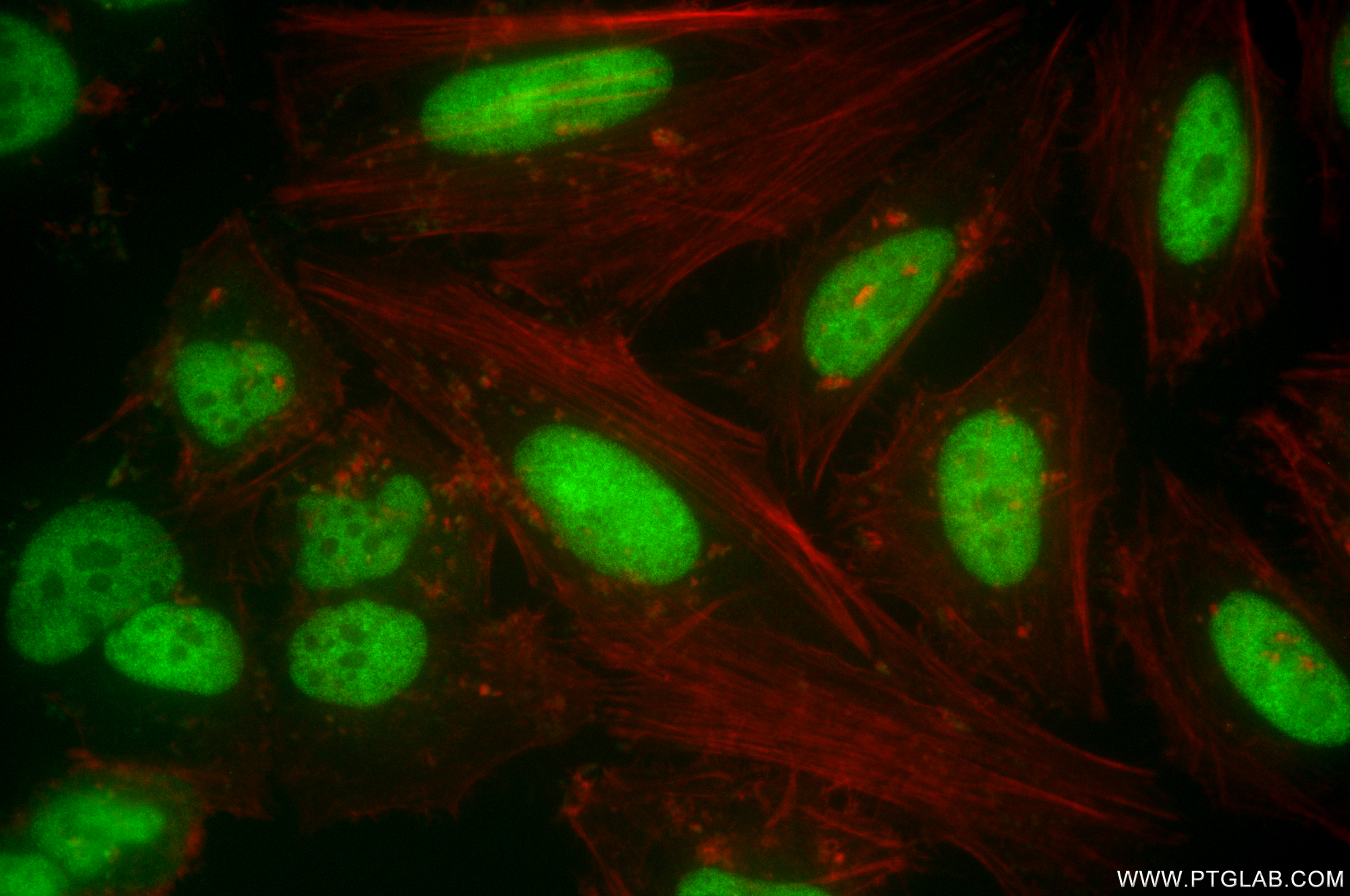 IF Staining of HeLa using 85370-2-RR