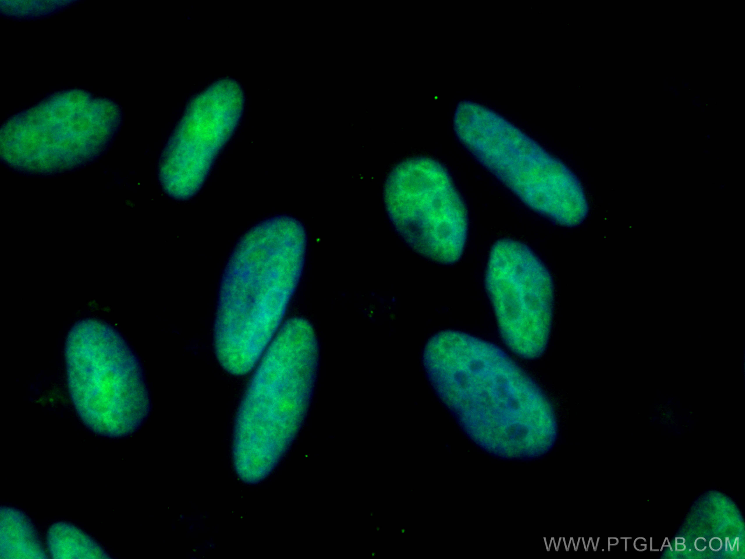 IF Staining of HeLa using CL488-28534