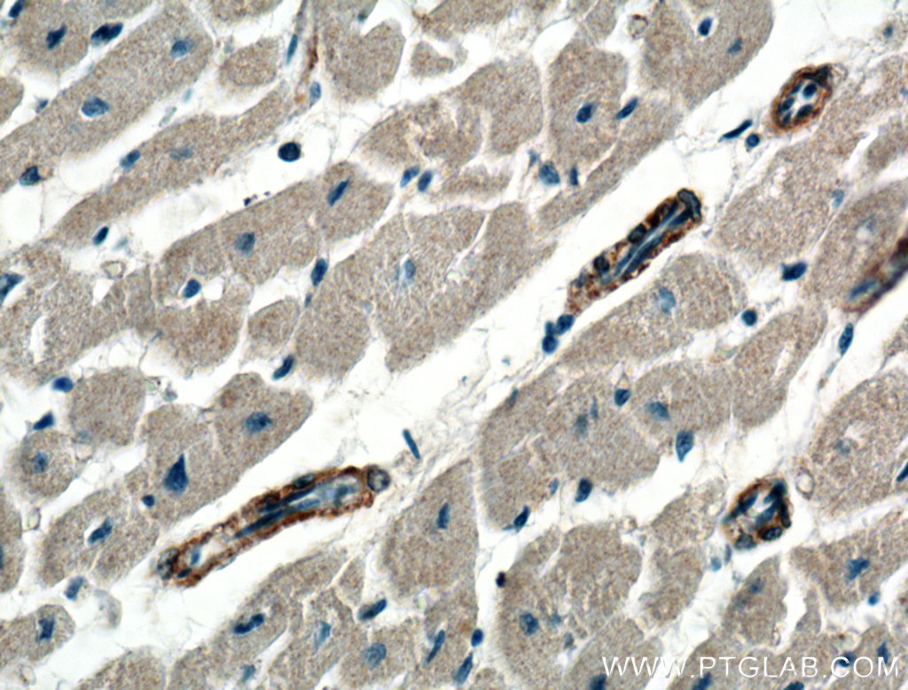 IHC staining of human heart using 21646-1-AP