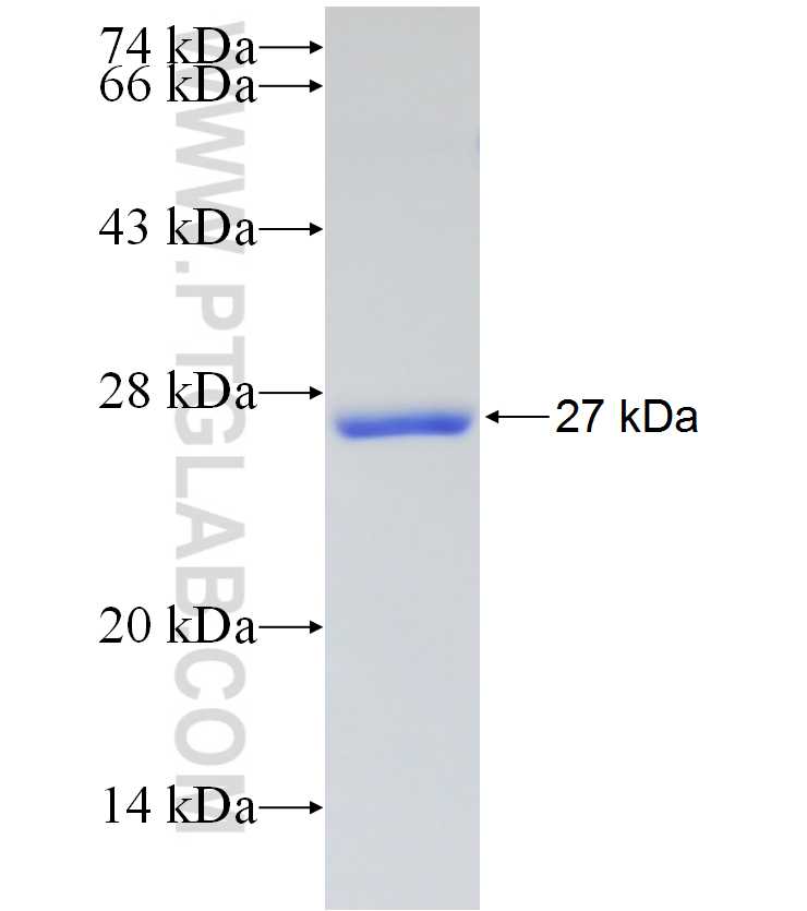 PRKG1 fusion protein Ag17987 SDS-PAGE PRKG1 fusion protein Ag17987 SDS-PAGE
