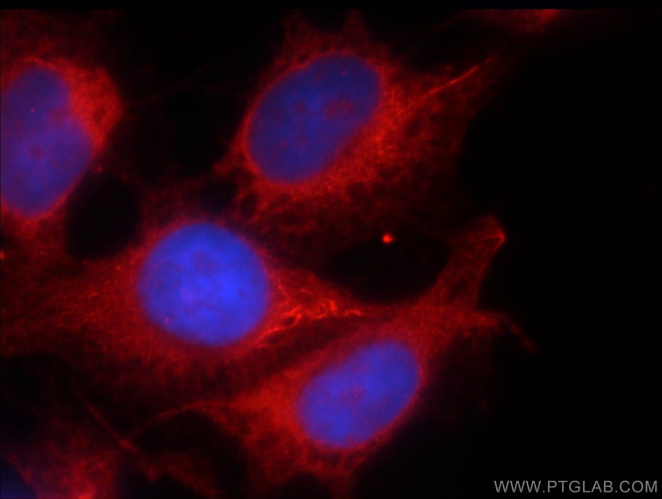 IF Staining of HUVEC using 55138-1-AP