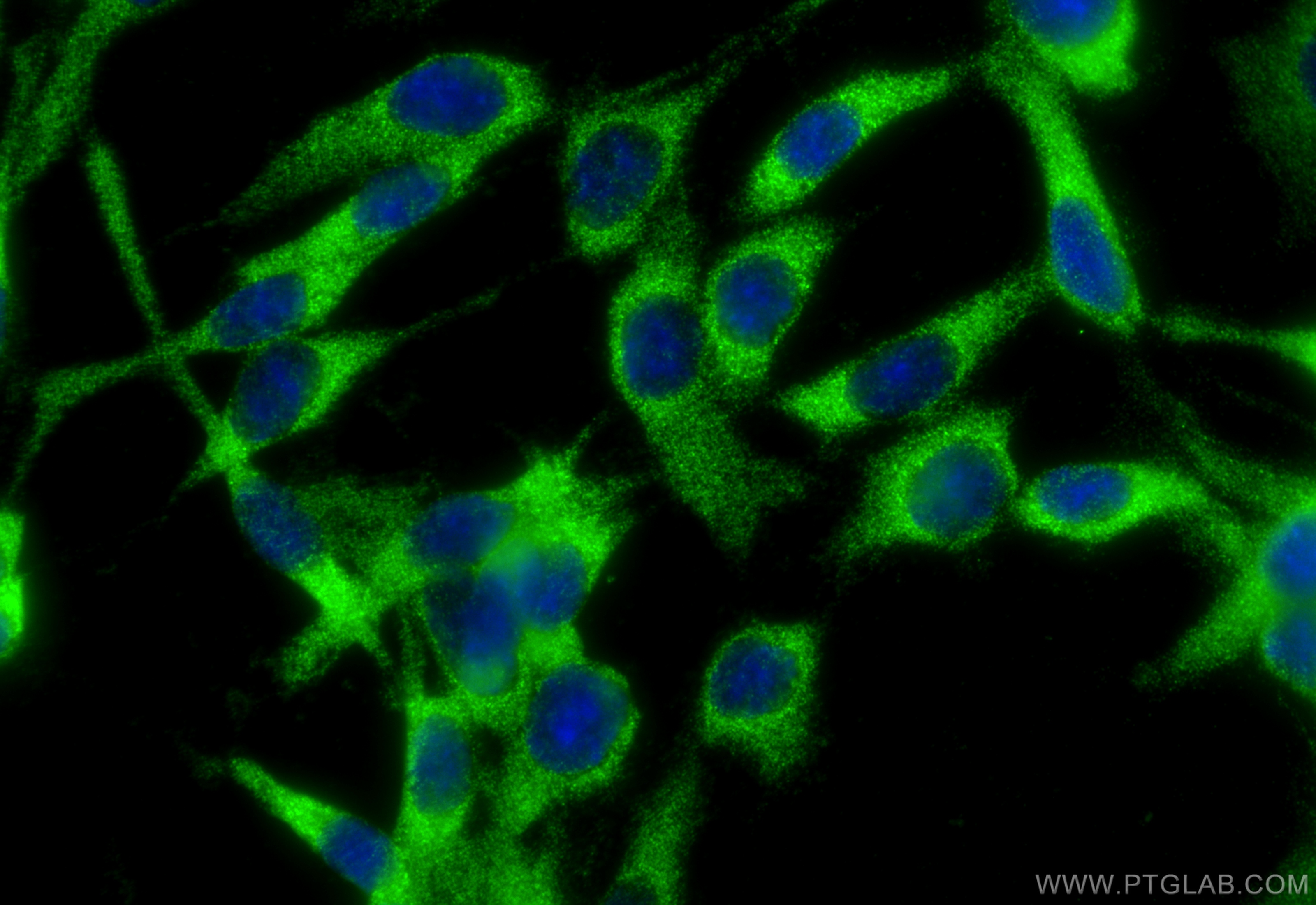 IF Staining of C6 using 55138-1-AP