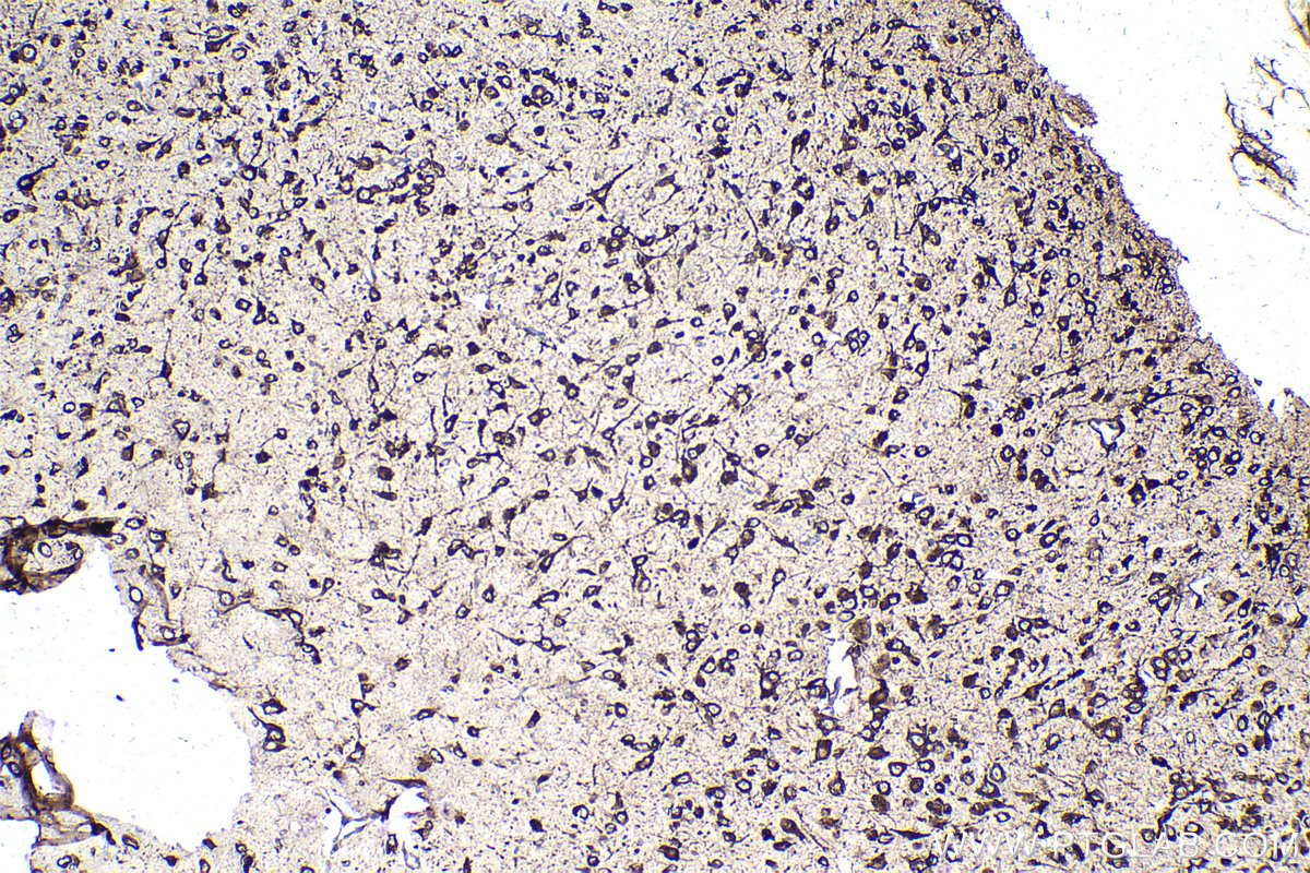 IHC staining of mouse brain using 68518-1-Ig (same clone as 68518-1-PBS)