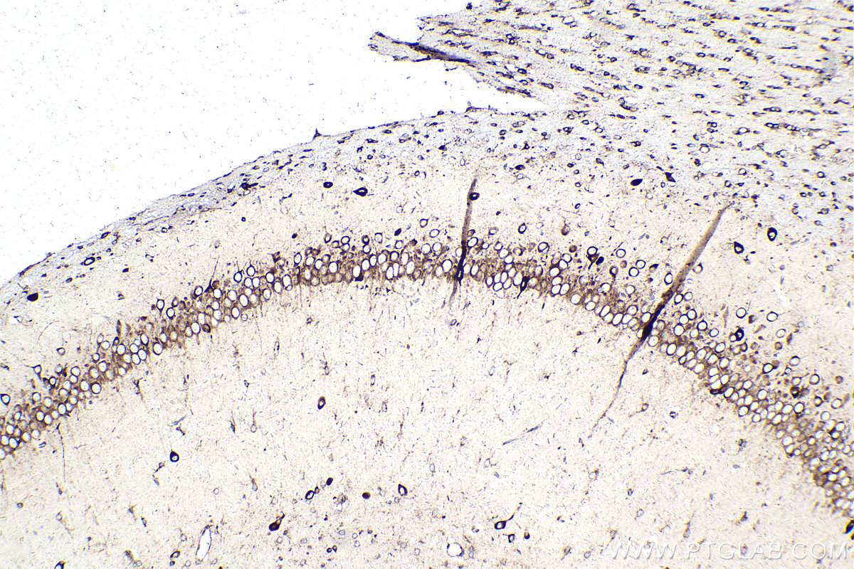 IHC staining of rat brain using 68518-1-Ig (same clone as 68518-1-PBS)