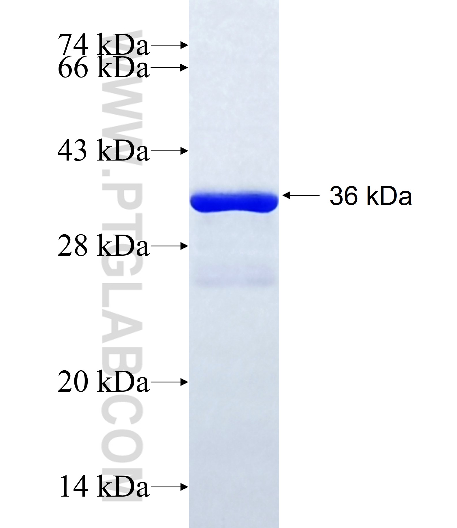 PRKRA fusion protein Ag34841 SDS-PAGE PRKRA fusion protein Ag34841 SDS-PAGE