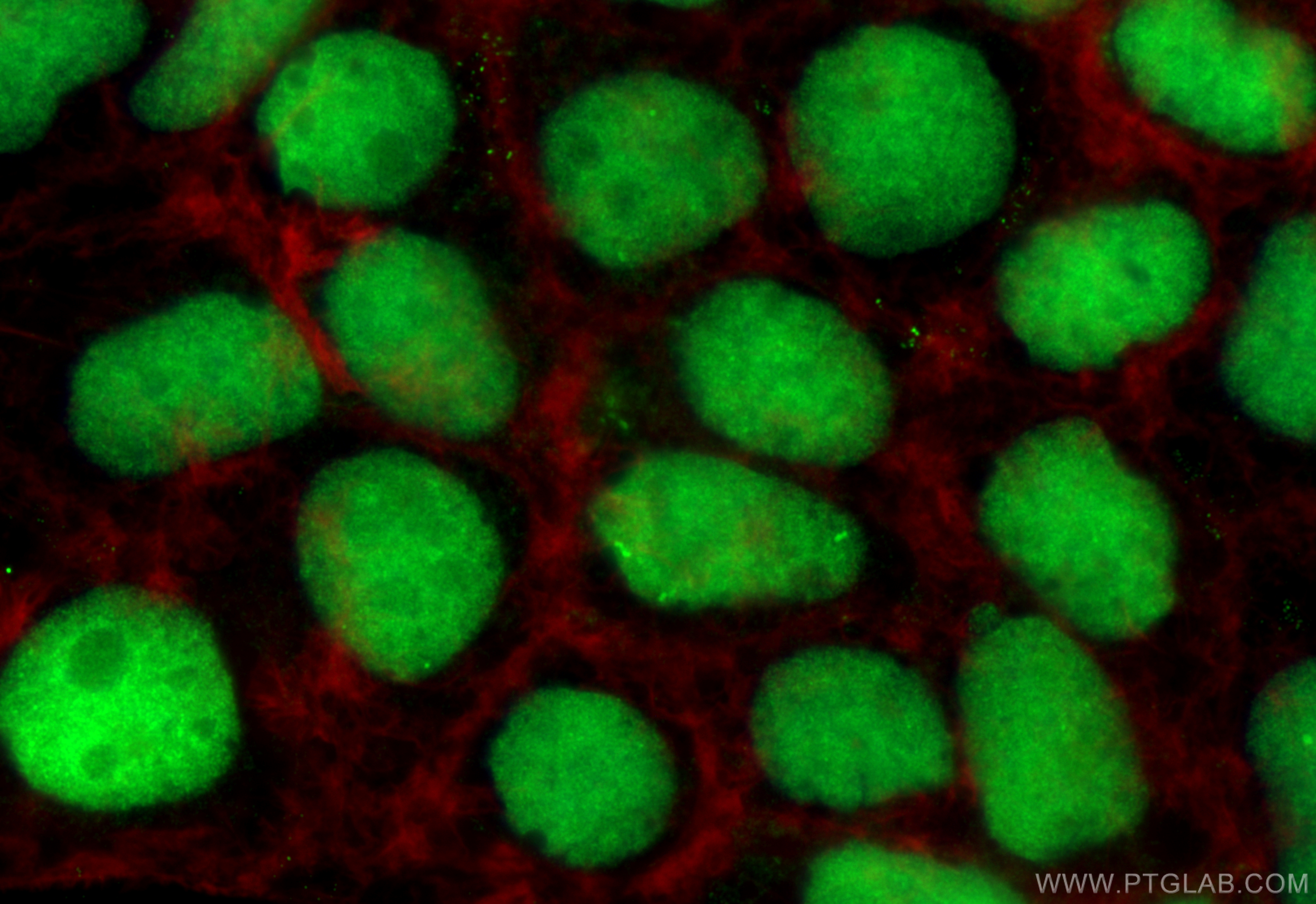 IF Staining of Caco-2 using 16794-1-AP
