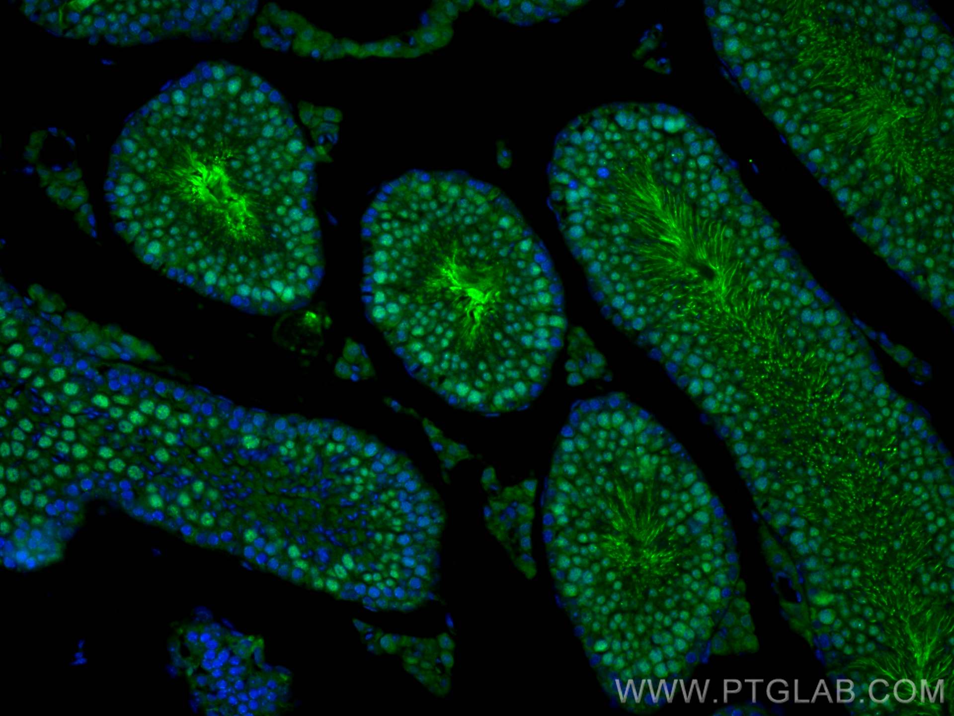 IF Staining of mouse testis using 15697-1-AP