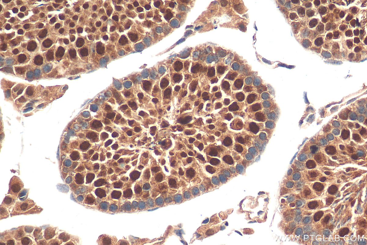 IHC staining of mouse testis using 15697-1-AP