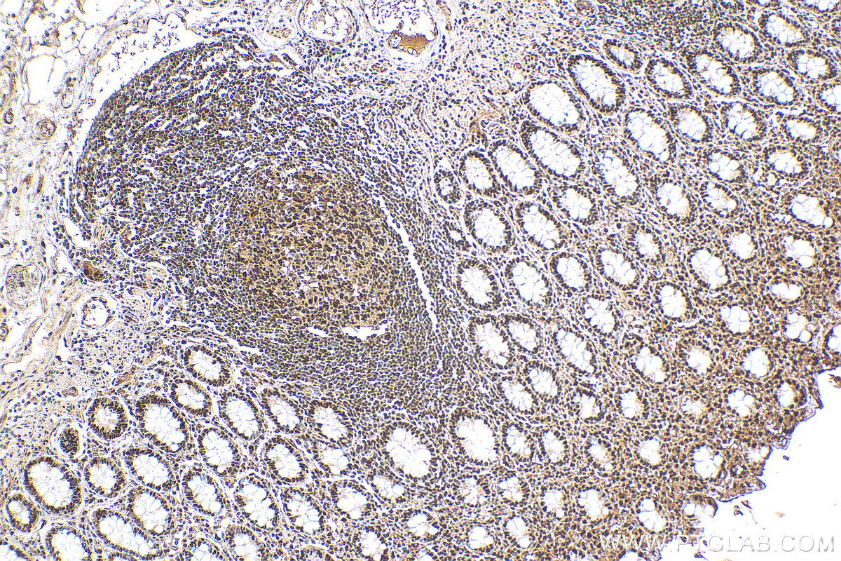 IHC staining of human colon using 11279-1-AP