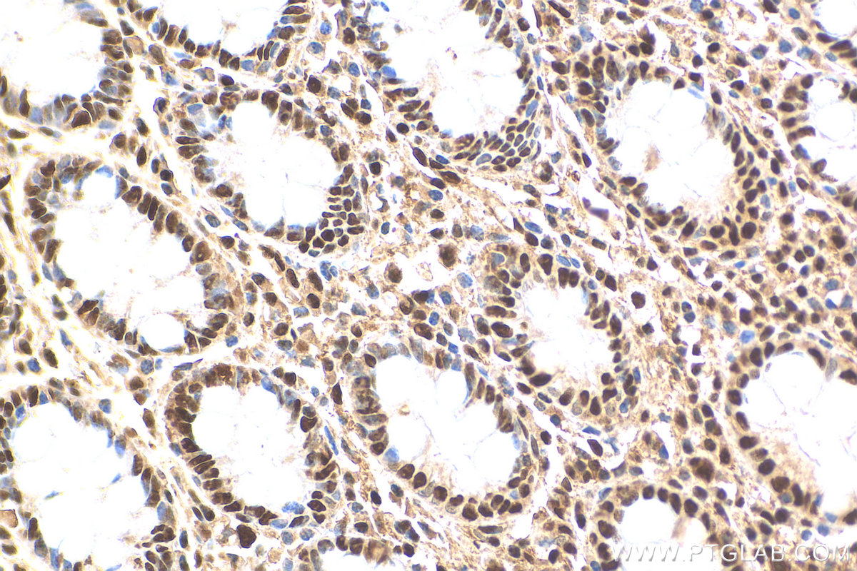 IHC staining of human colon using 11279-1-AP