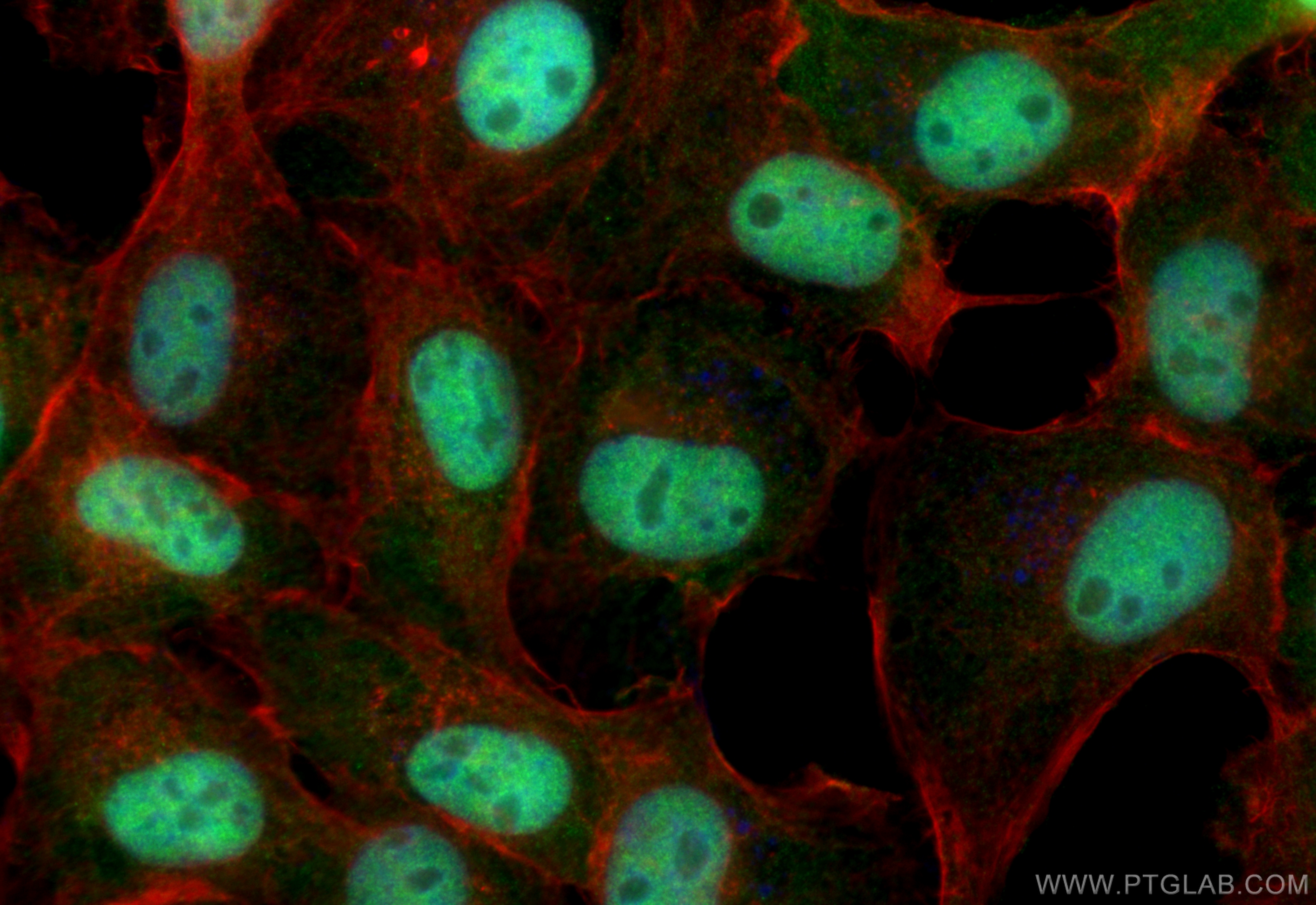 IF Staining of A431 using 68365-1-Ig