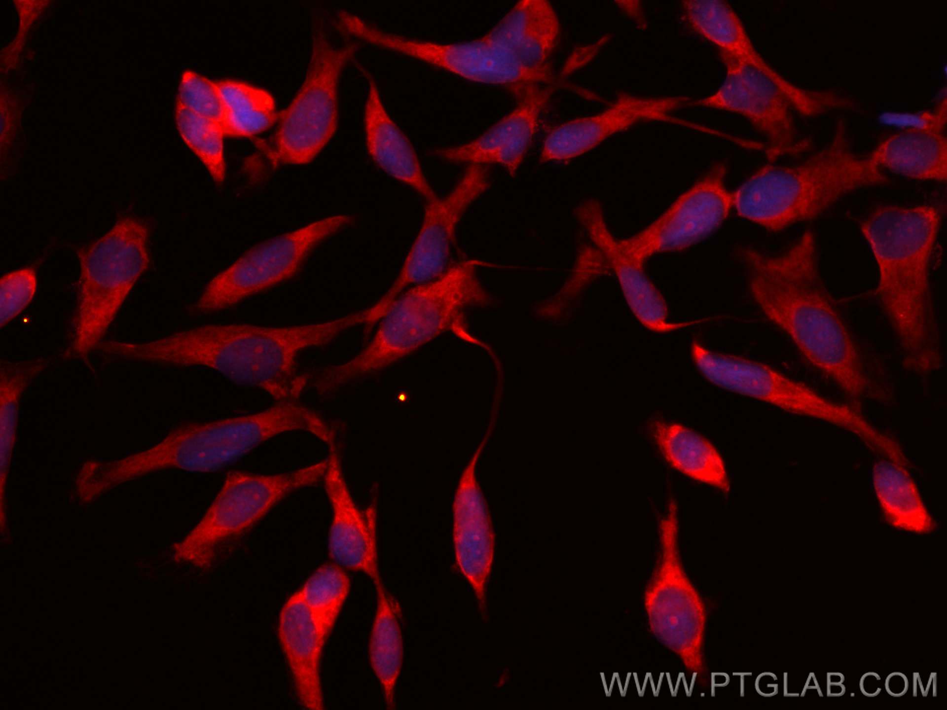 IF Staining of HeLa using CL594-66885