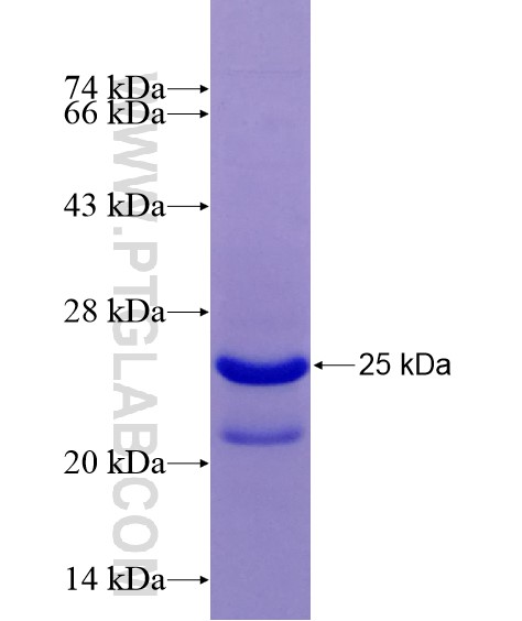 PRMT2 fusion protein Ag28980 SDS-PAGE PRMT2 fusion protein Ag28980 SDS-PAGE