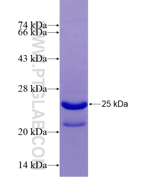 PRMT2 fusion protein Ag28980 SDS-PAGE