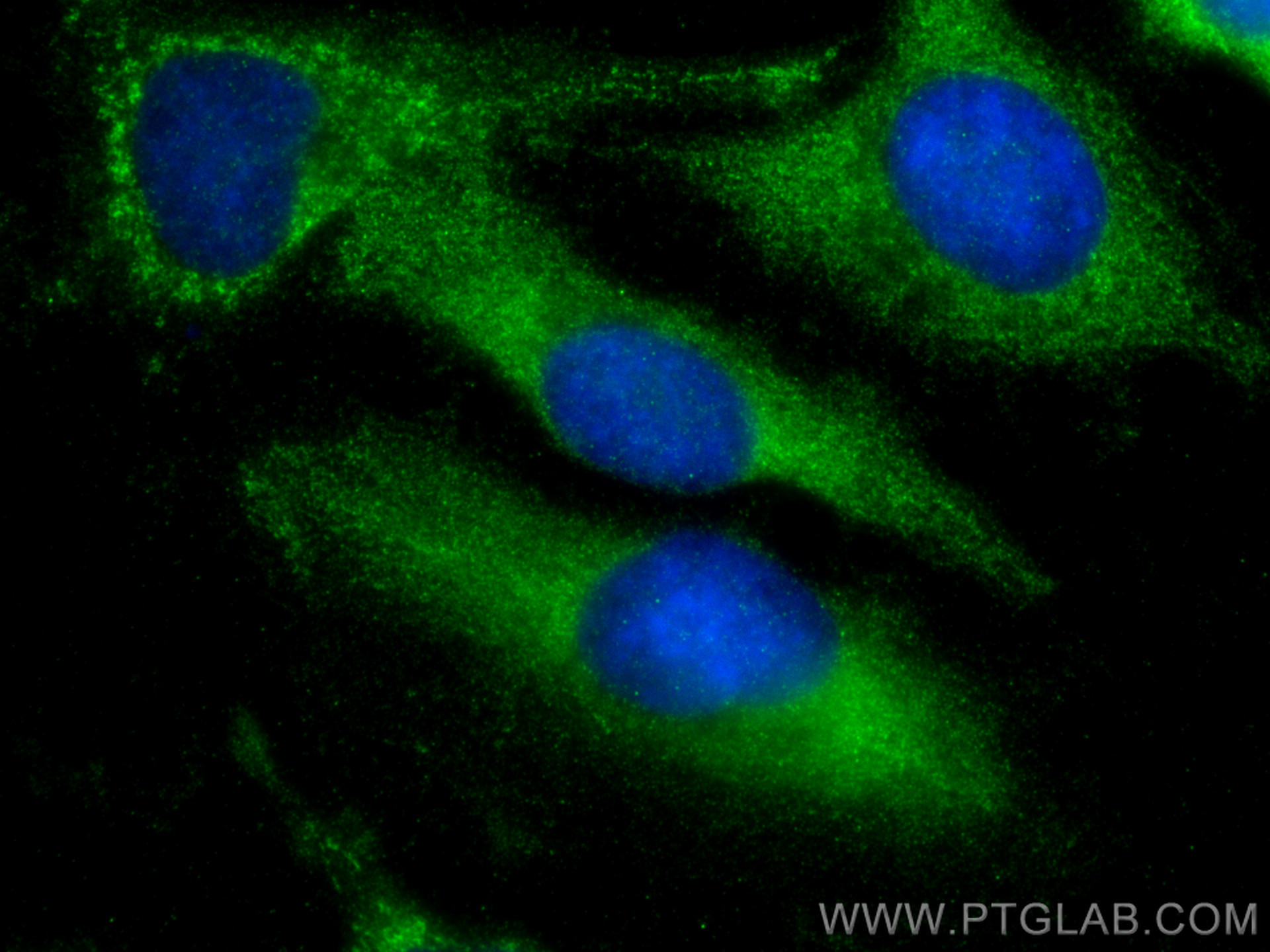 IF Staining of HeLa using 17628-1-AP