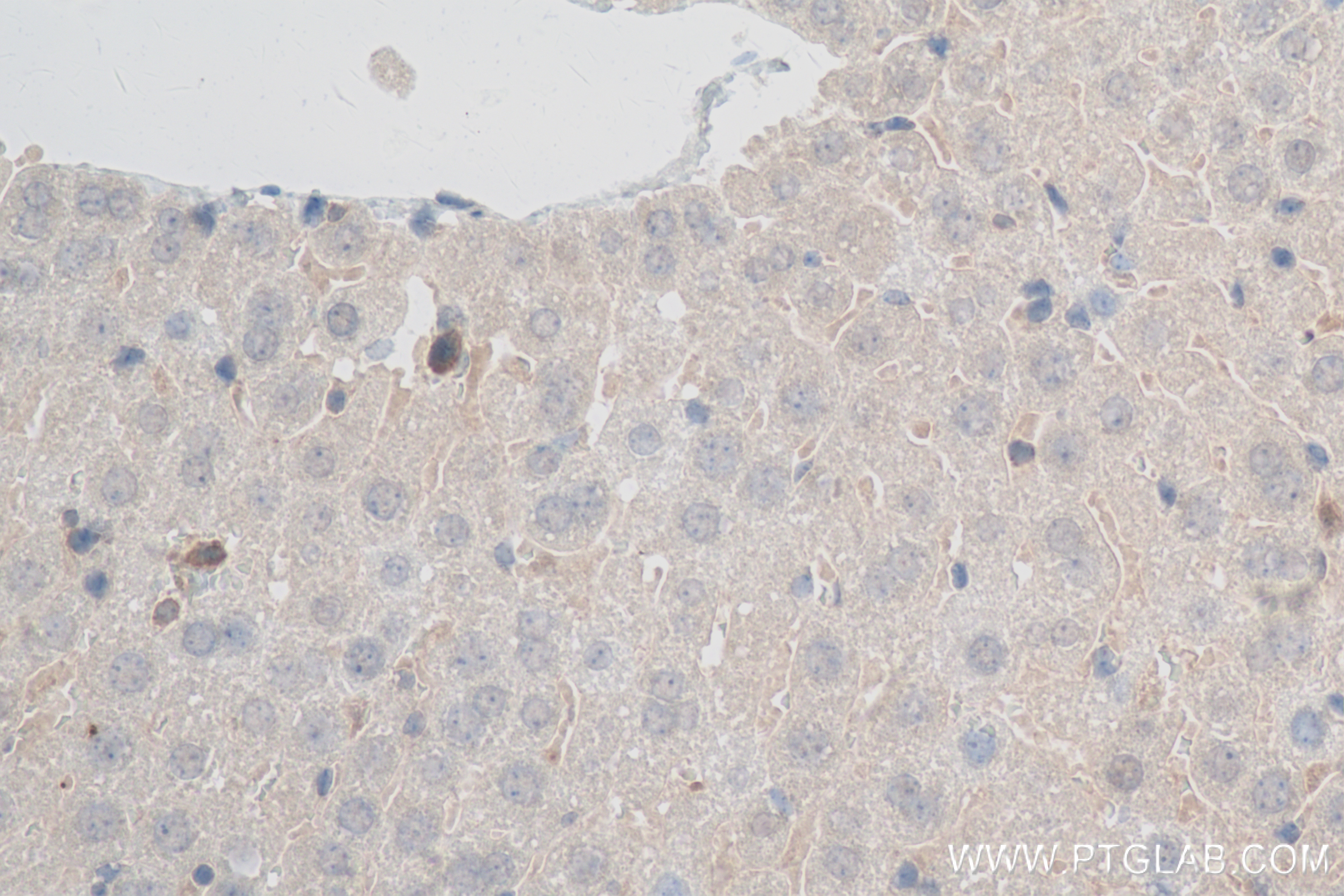 IHC staining of mouse liver using 83969-6-RR