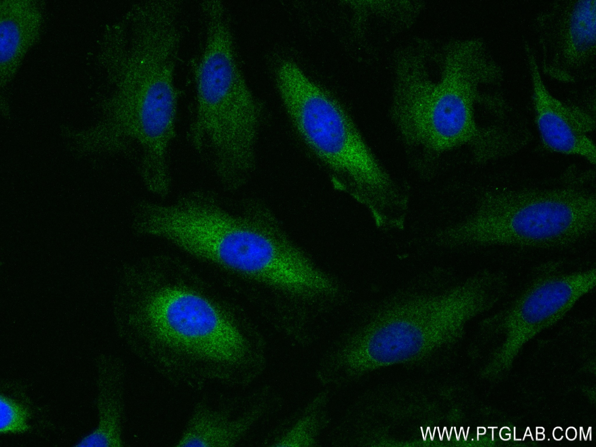 IF Staining of HeLa using 83969-7-RR (same clone as 83969-7-PBS)