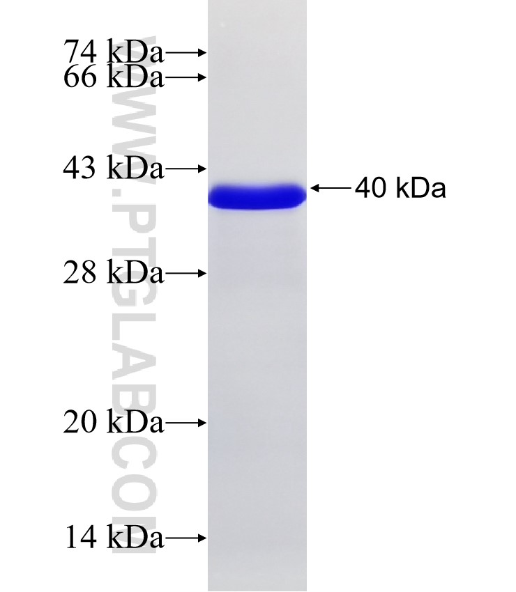 PRMT3 fusion protein Ag33118 SDS-PAGE PRMT3 fusion protein Ag33118 SDS-PAGE