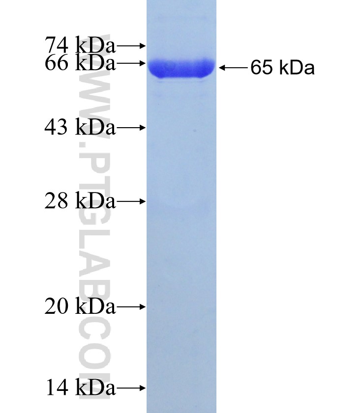 PRMT3 fusion protein Ag13466 SDS-PAGE