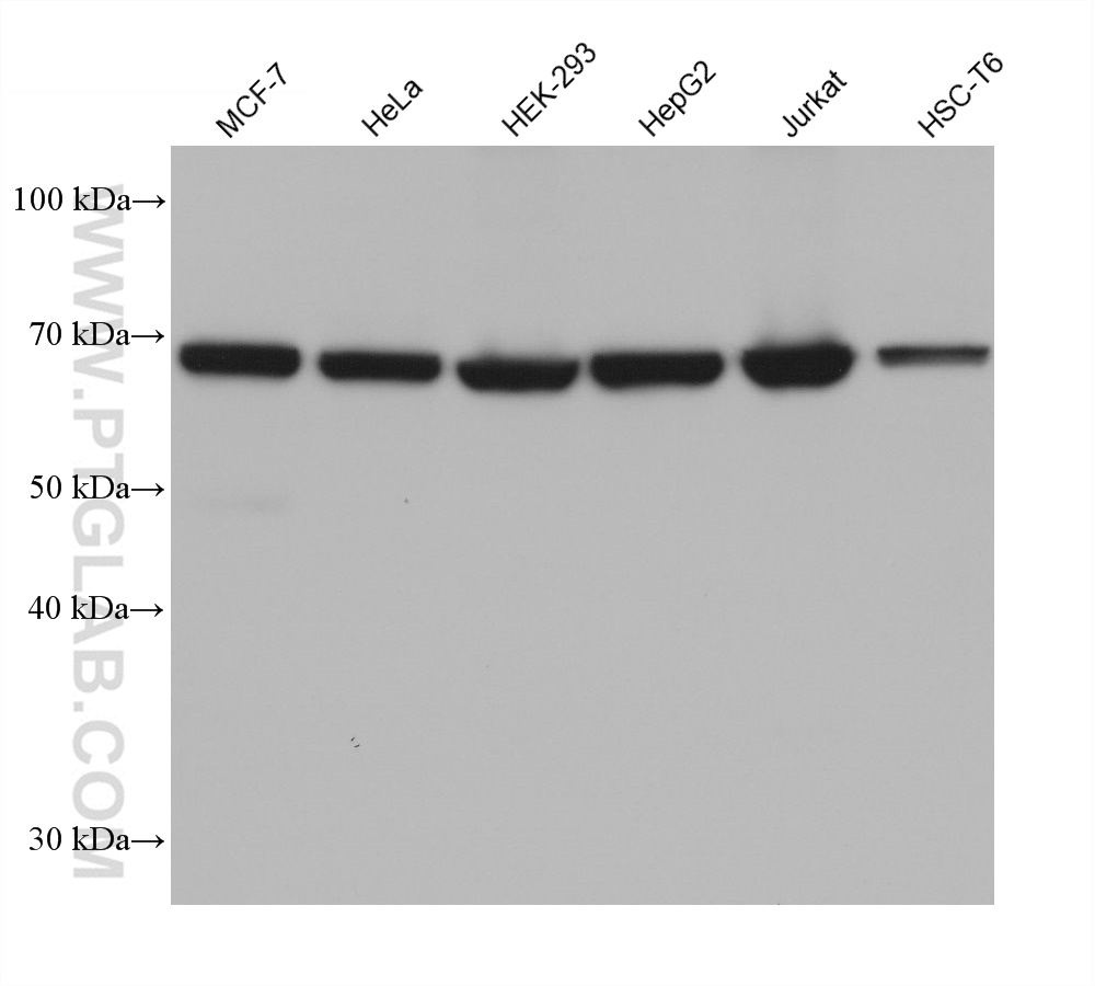 WB analysis using 68534-1-Ig