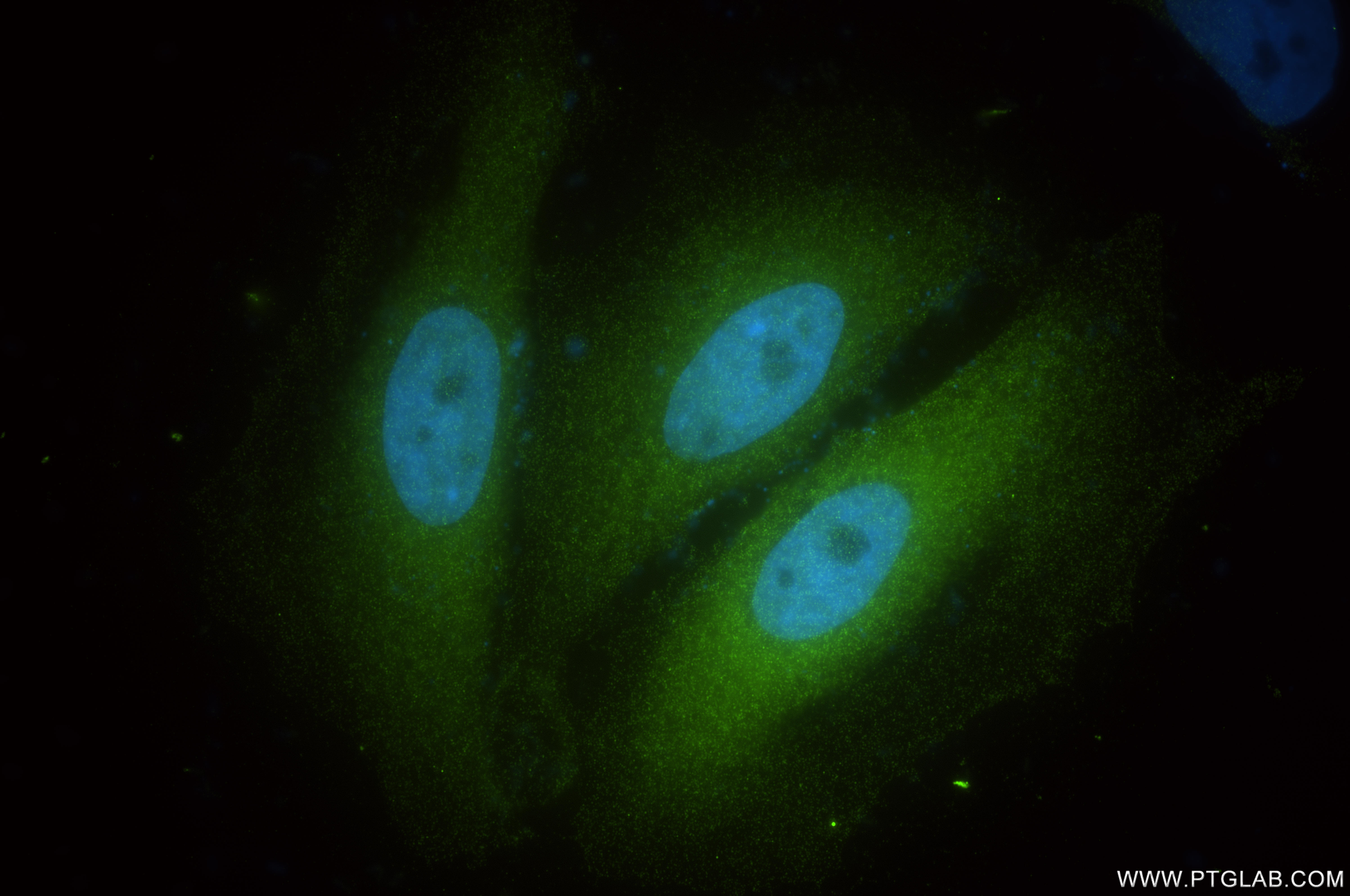 IF Staining of HeLa using 82750-2-RR
