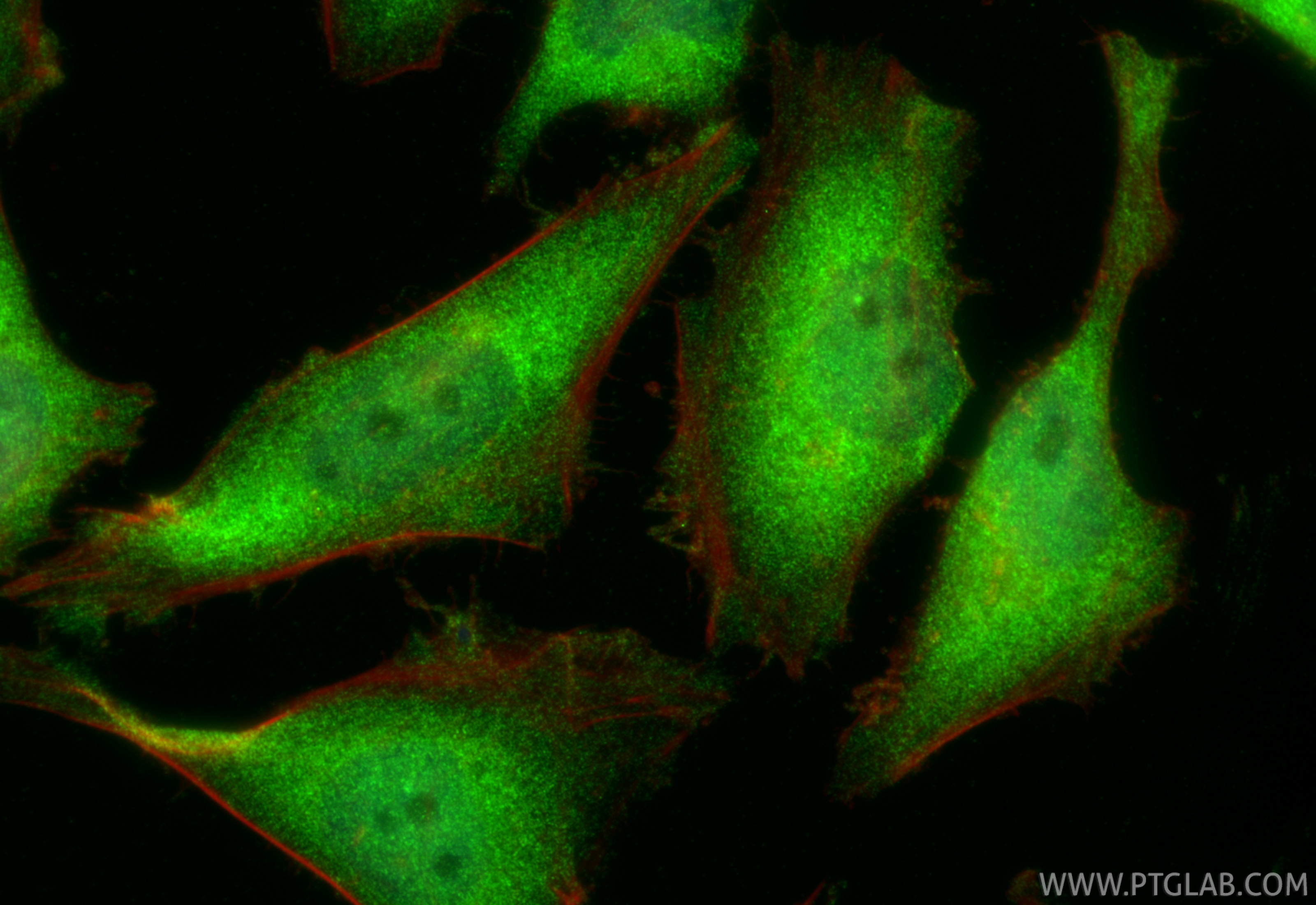 IF Staining of HeLa using RMX00051 IF Staining of HeLa using RMX00051