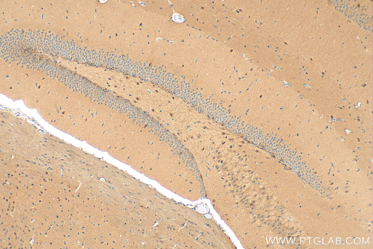 IHC staining of mouse brain using RMX00051 IHC staining of mouse brain using RMX00051