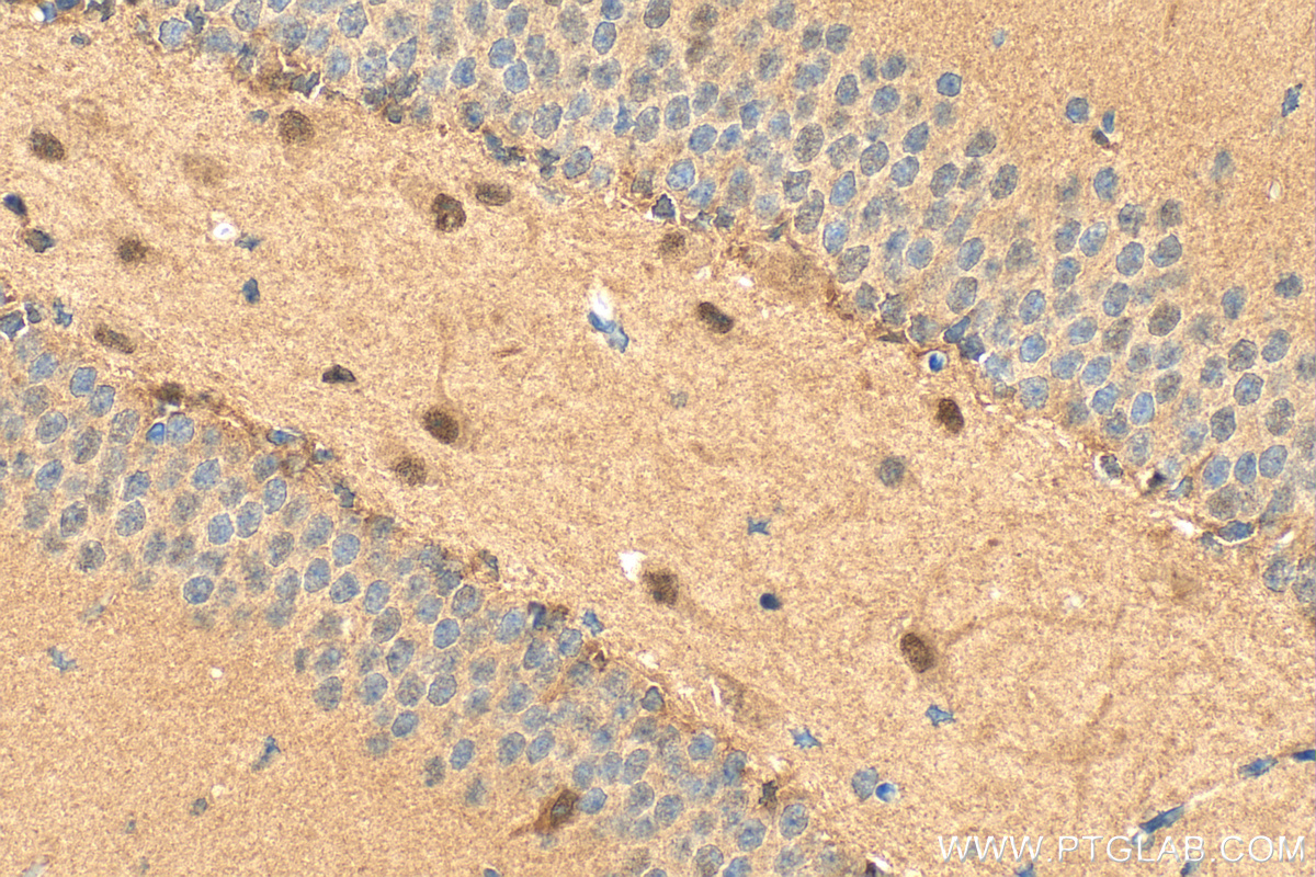 IHC staining of mouse brain using RMX00051 IHC staining of mouse brain using RMX00051