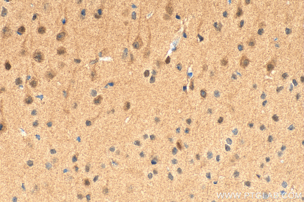 IHC staining of mouse brain using RMX00051 IHC staining of mouse brain using RMX00051