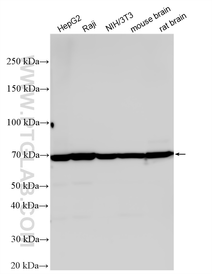 WB analysis using RMX00051 WB analysis using RMX00051