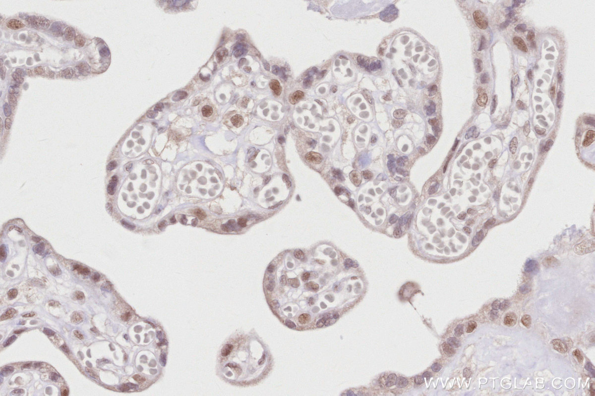 IHC staining of human placenta using 15395-1-AP IHC staining of human placenta using 15395-1-AP