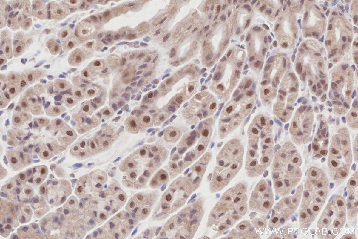 IHC staining of mouse stomach using 15395-1-AP IHC staining of mouse stomach using 15395-1-AP