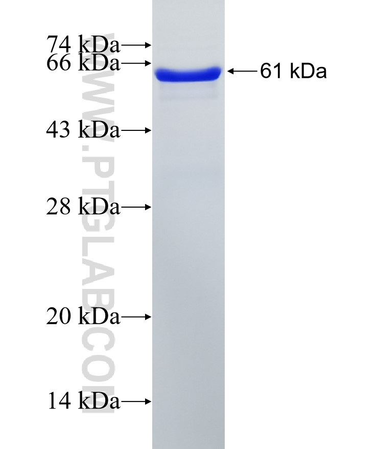 PRMT6 fusion protein Ag7592 SDS-PAGE