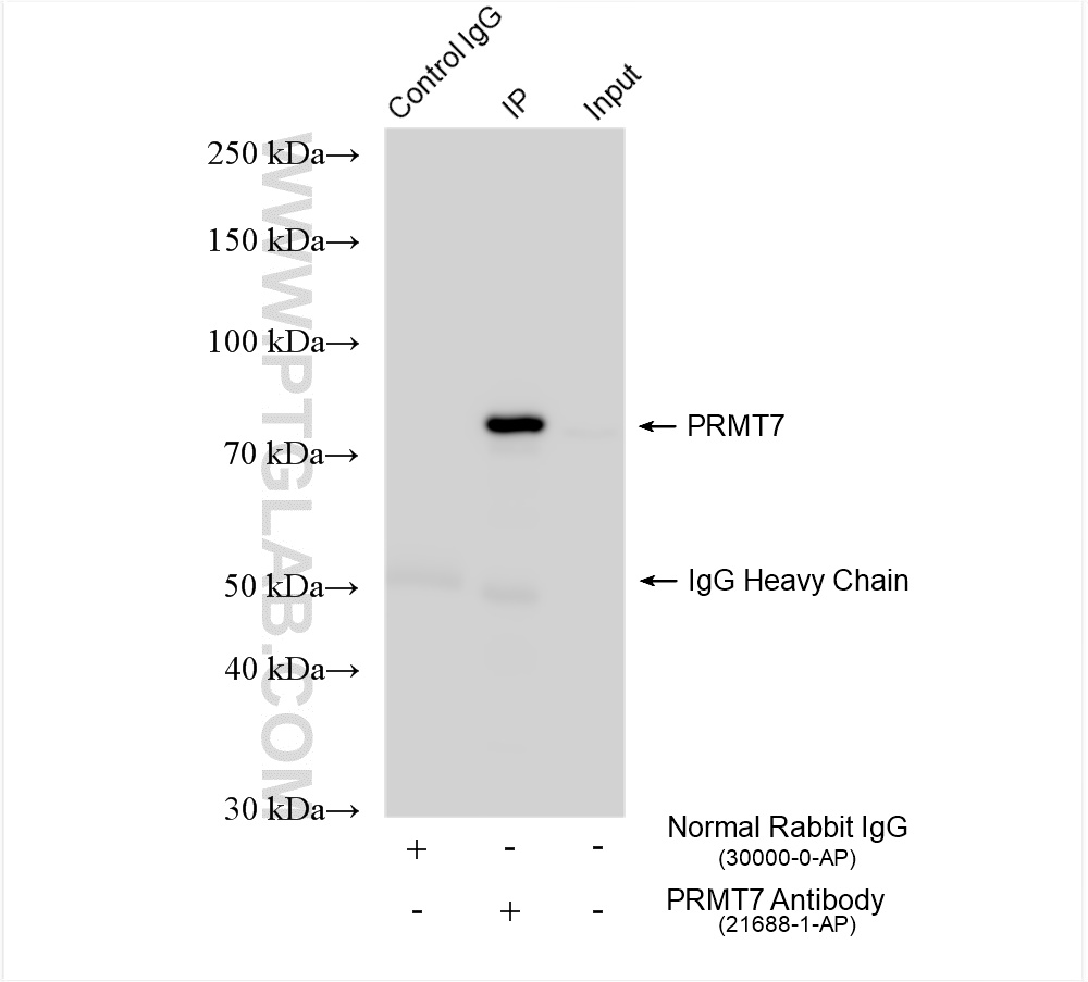 IP experiment of HeLa using 21688-1-AP