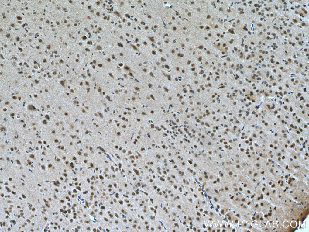 IHC staining of rat brain using 12557-1-AP