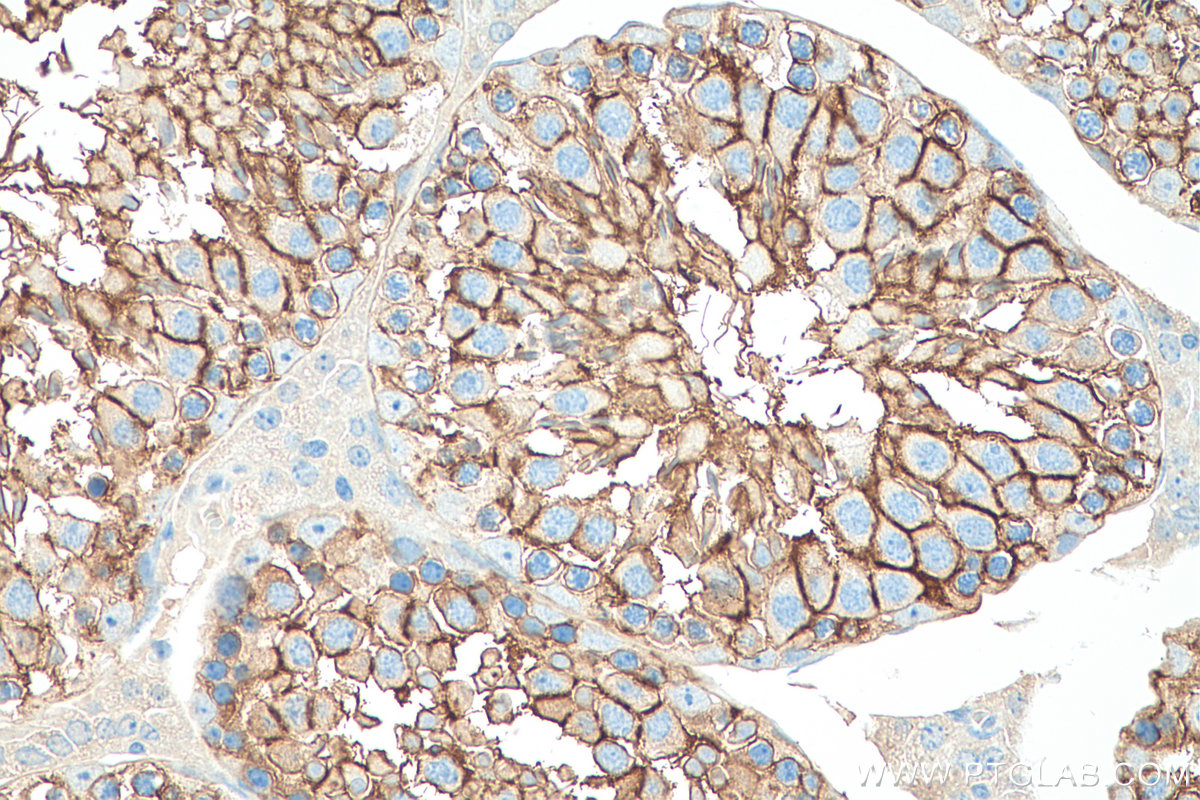 IHC staining of mouse testis using 26947-1-AP