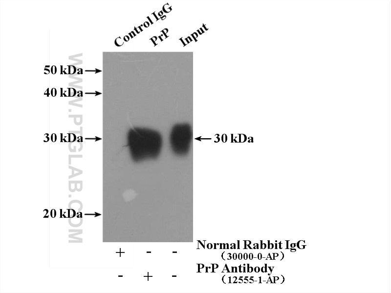 IP experiment of mouse brain using 12555-1-AP (same clone as 12555-1-PBS)