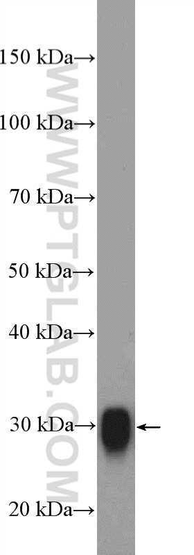 WB analysis of mouse brain using 12555-1-AP (same clone as 12555-1-PBS)