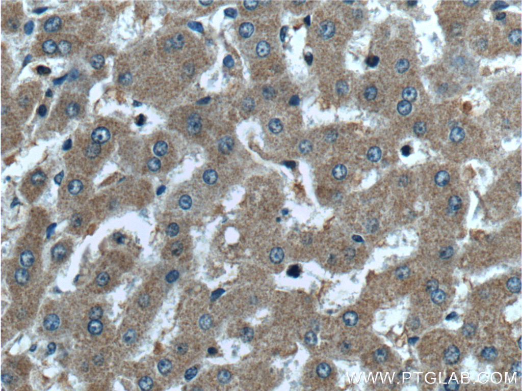 IHC staining of human liver using 25382-1-AP