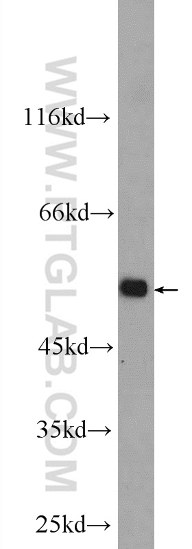 PROC Polyclonal antibody