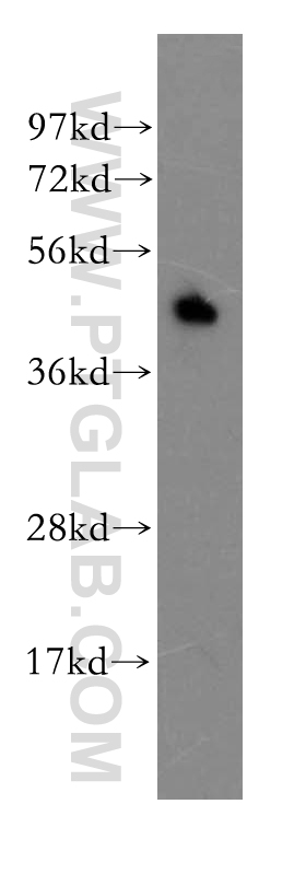 WB analysis of human spleen using 11391-1-AP