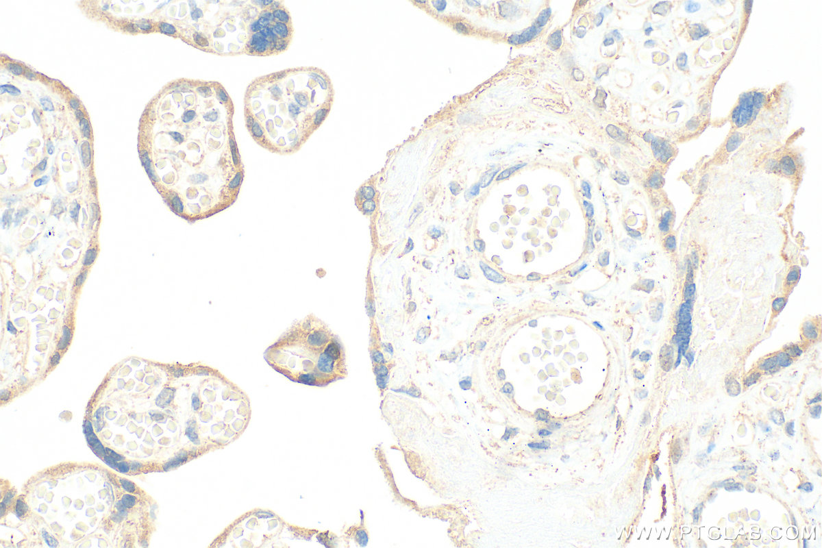 IHC staining of human placenta using 32134-1-AP