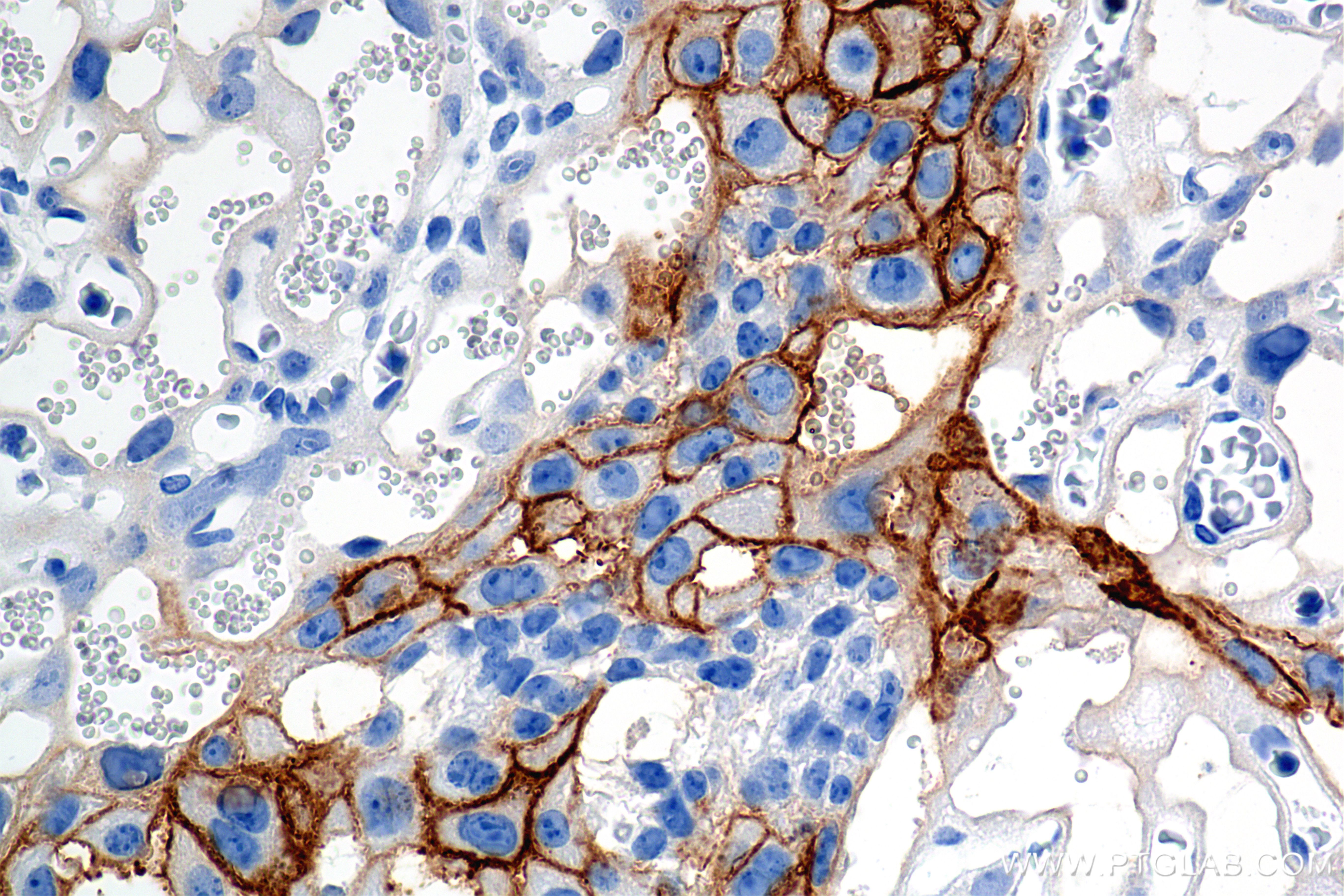 IHC staining of mouse placenta using 84494-2-RR