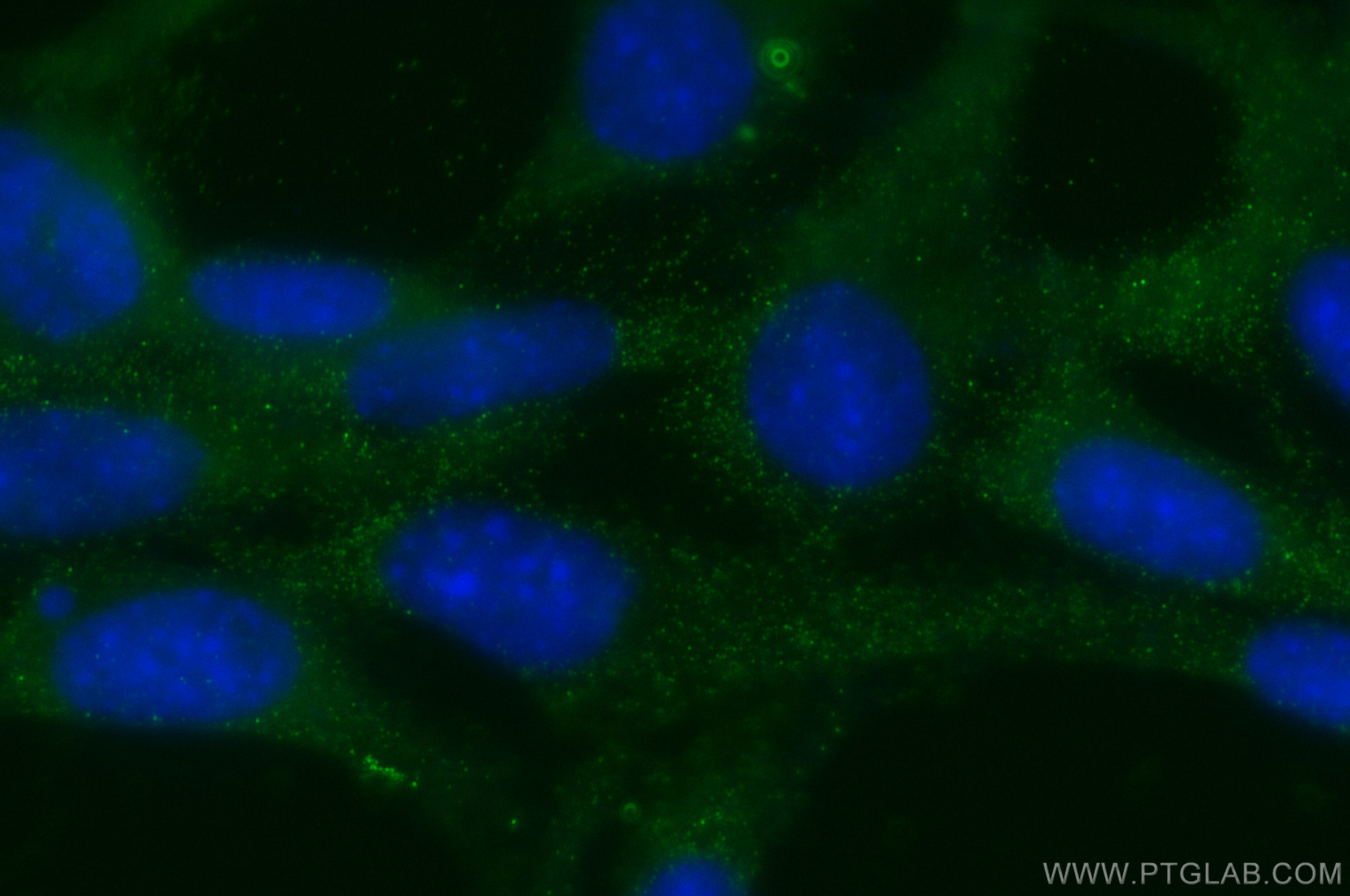 Prokineticin 1